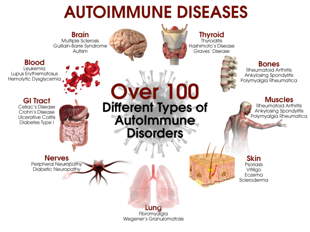 5857471efe2f30a74fb4d41b_Autoimmune Diseases
